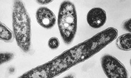 墨尔本军团病爆发确认第二例死亡