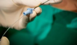 患者控制的镇痛不等同于硬膜外镇痛在分娩过程中缓解疼痛