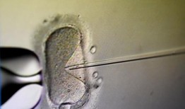 医疗组织警告称，阿拉巴马州最高法院审理的案件可能会关闭生育诊所