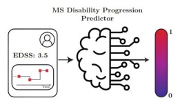 机器学习显示了预测多发性硬化症进展的潜力