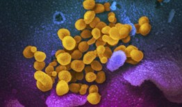 如果你的COVID检测呈阳性，你现在应该怎么做？你应该隔离多久？